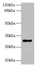 IHC-plus™ Polyclonal Rabbit anti-Human HLA-DRB4 Antibody (IHC, WB)