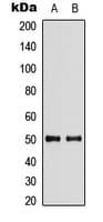 Polyclonal Rabbit anti-Human SLC29A2 / ENT2 Antibody (Internal, WB)