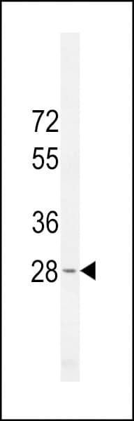 Polyclonal Rabbit anti-Human METTL10 Antibody (aa29-57, IHC, WB)