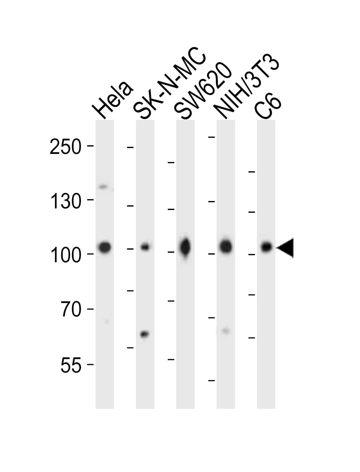 CTNNB1 / Beta Catenin Antibody (aa736-749)