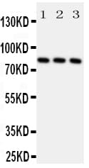 Polyclonal Rabbit anti-Human RPS6KA1 / RSK1 Antibody (aa721-735, WB)