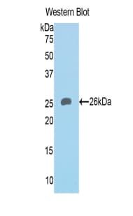 HAVCR1 / KIM-1 Antibody (aa16-231)