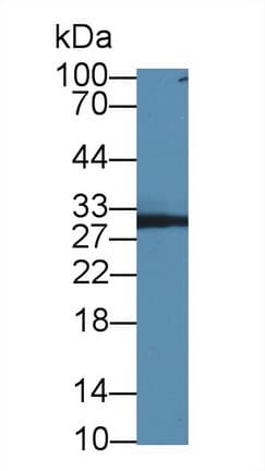 PNP / Nucleoside Phosphorylase Antibody