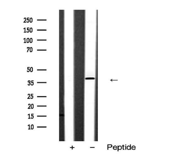 Polyclonal Rabbit anti-Human SIAH2 Antibody (IHC, IF, WB)