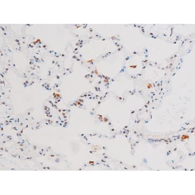 RELA / NFKB p65 Antibody (phospho-Ser281)