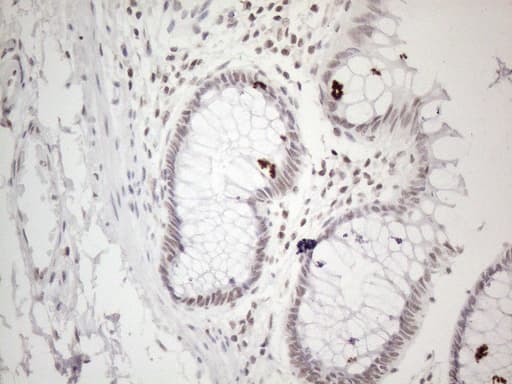 MMP2 Antibody (aa228-507, clone OTI4A11)