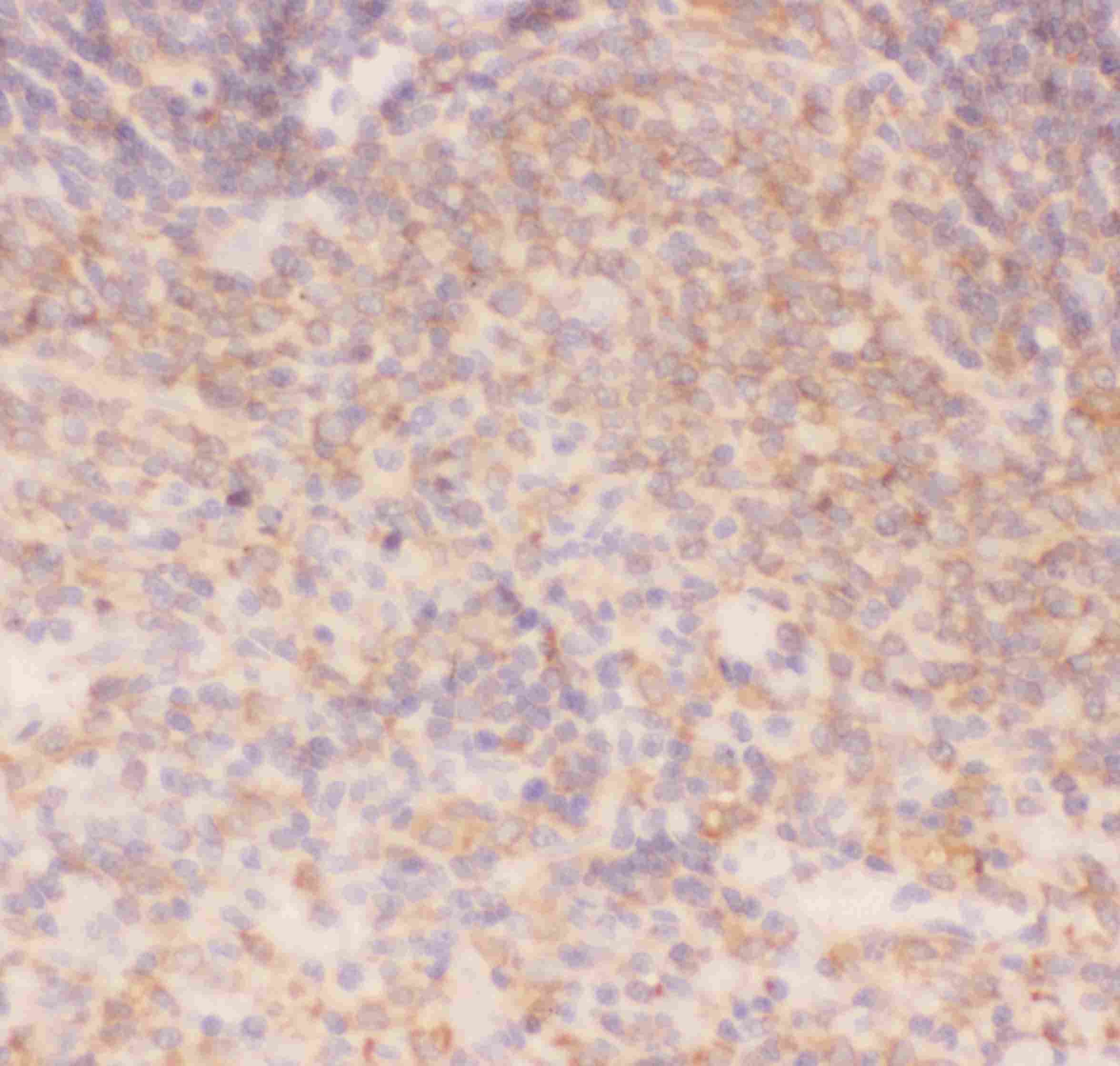 Polyclonal Rabbit anti-Human CHUK / IKKA / IKK Alpha Antibody (aa411-745, IHC, WB)