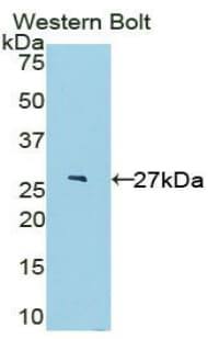IL-22BP / IL22RA2 Antibody (aa30-228)