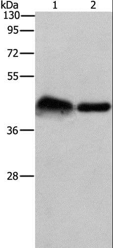 Polyclonal Rabbit anti-Human CRELD1 Antibody (IHC, WB)