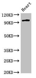 PKD3 / PRKD3 Antibody