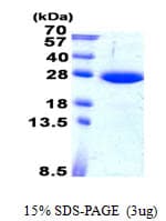 Human SARA2 / SAR1B Protein (Recombinant His)
