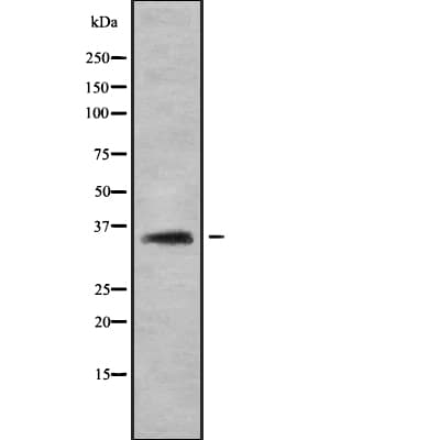 Polyclonal Rabbit anti-Human OR2C3 Antibody (IHC, IF, WB)