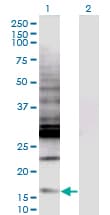 CREBL2 Antibody (clone 1C1)