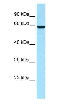 DPYSL4 / CRMP3 Antibody (C-Terminus)