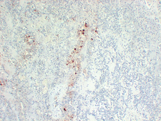 FSHB / FSH Beta Antibody (clone ABT-FSH)