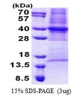 Human COPS6 / CSN6 Protein (Recombinant His)