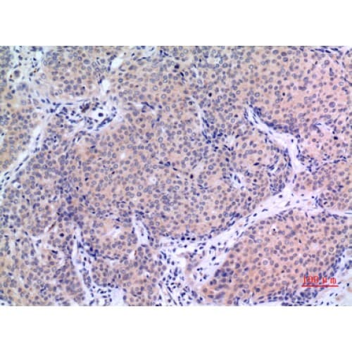 Polyclonal Rabbit anti-Human VGF Antibody (441-490 aa, Internal, IHC, WB)