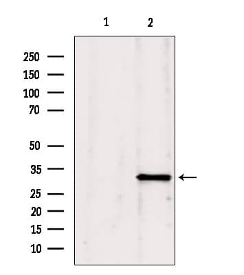 GNMT Antibody