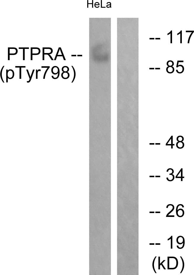 PTPRA / RPTP-Alpha Antibody (phospho-Tyr798)