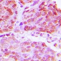 Polyclonal Rabbit anti-Human TTF1 / Txn Termination Factor Antibody (N-Terminus, IHC, WB)