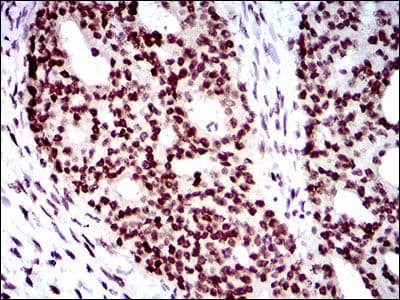 NELFA / WHSC2 Antibody (Amino Acid: 280-511, clone 6B11H8)