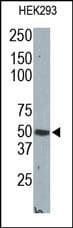 Polyclonal Rabbit anti-Human CPA2 Antibody (WB)