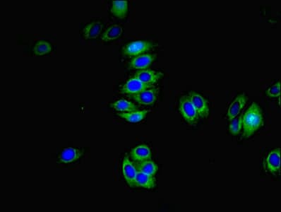 Polyclonal Rabbit anti-Human TMEM82 Antibody
