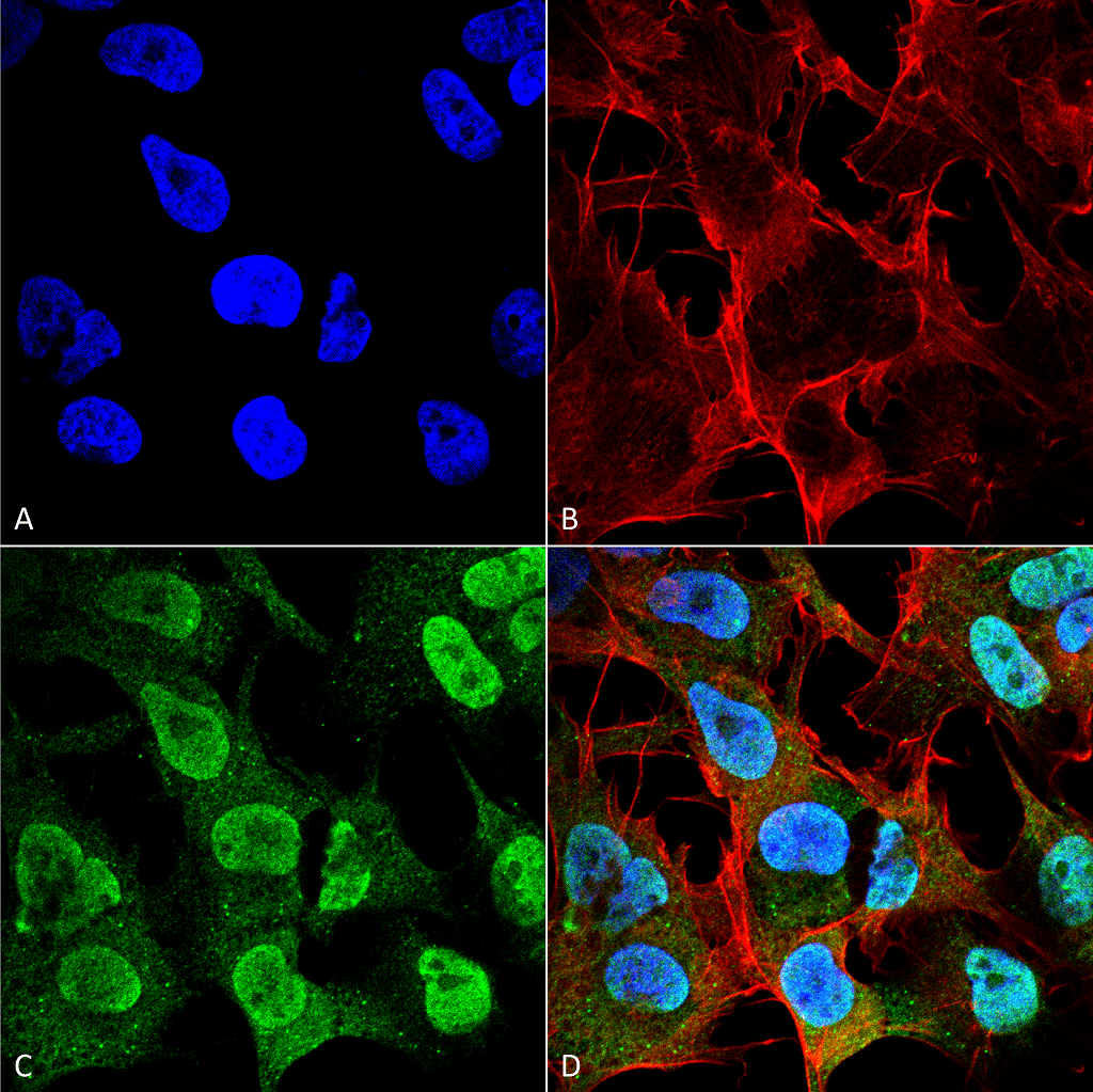 Monoclonal Mouse anti-Human SNCA / Alpha-Synuclein Antibody (clone 4F1, Biotin, IHC, IF, WB)