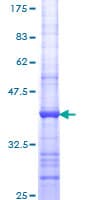 Human ENO1 / Alpha Enolase Protein (Recombinant GST, N-terminus)