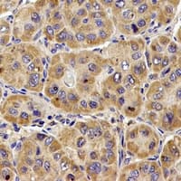 LAMP2 / CD107b Antibody (Internal)