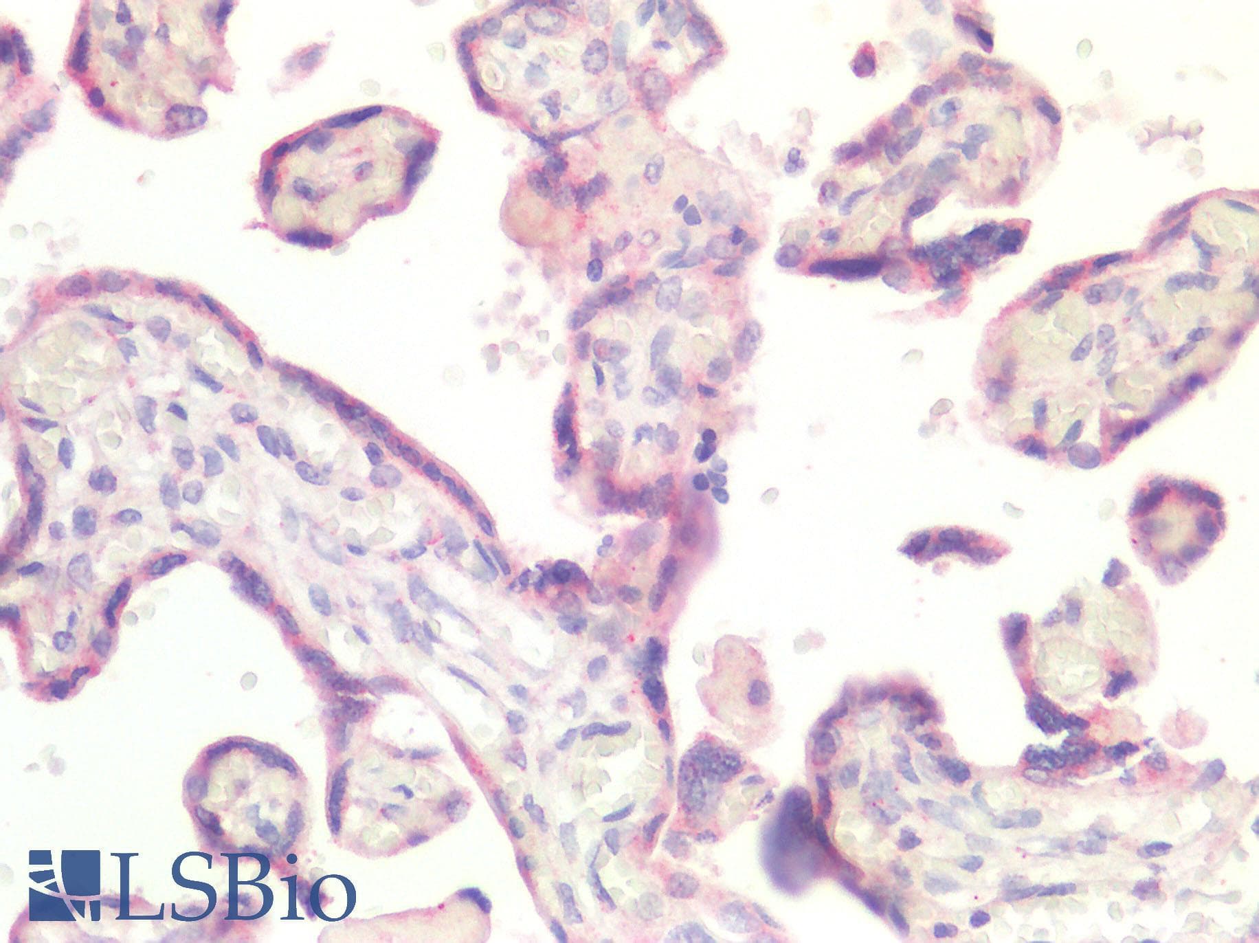 IHC-plus™ IFIH1 / MDA5 Antibody