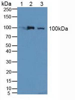 NCL / Nucleolin Antibody (aa388-569, Biotin)