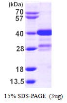 Human MLF1 Protein (Recombinant His)