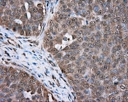 ERCC1 Antibody (clone OTI1G6)