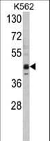 SETD8 / SET8 Antibody (aa362-393)