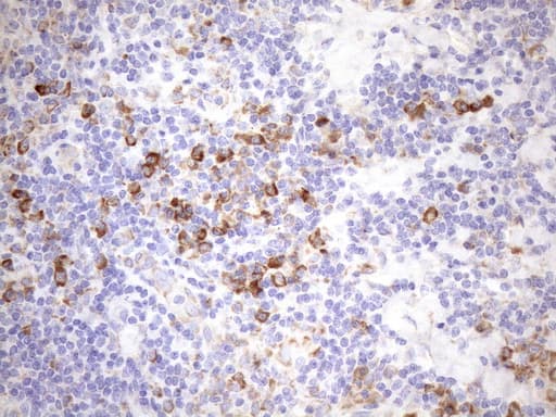 Monoclonal Mouse anti-Human NT5E / eNT / CD73 Antibody (clone OTI1G2, Carrier-free, aa119-232, IHC, WB)