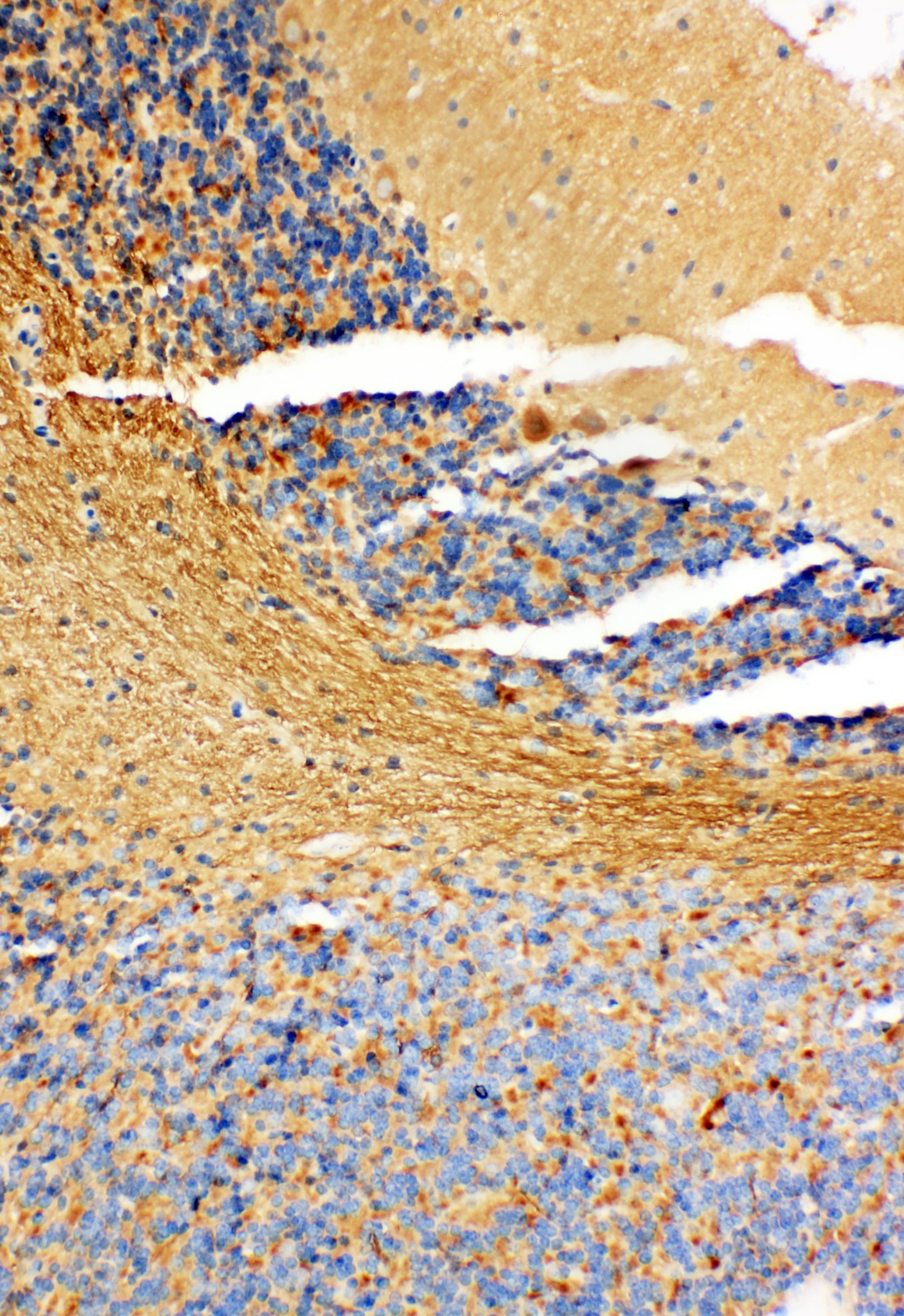 NME1 / NM23 Antibody (aa137-152)