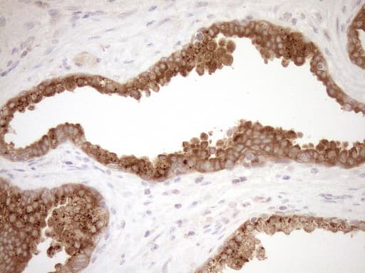 Monoclonal Mouse anti-Human CSA / ERCC8 Antibody (clone OTI1G2, IHC, WB)