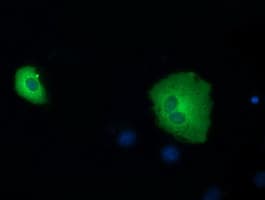 Monoclonal Mouse anti-Human SDR9C7 Antibody (clone OTI7E11, IF, WB)