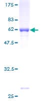 Human GRHPR / Glyoxylate Reductase Protein (Recombinant GST)