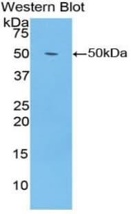 ENO1 / Alpha Enolase Antibody