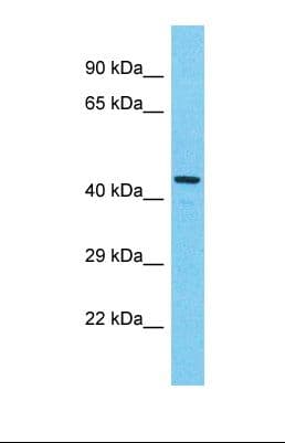 KIAA0895L Antibody (aa129-178)