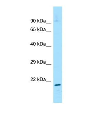 Polyclonal Rabbit anti-Mouse GTF2H2 Antibody (aa29-78, WB)