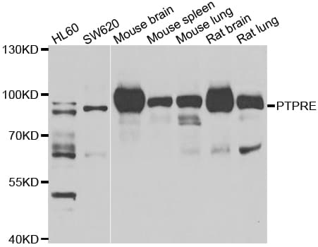 Polyclonal Rabbit anti-Human PTPRE / PTP Epsilon Antibody (IHC, WB)