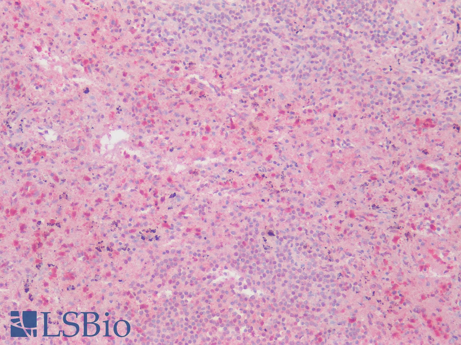 PathPlus™ GPRC5D Antibody (N-Terminus)