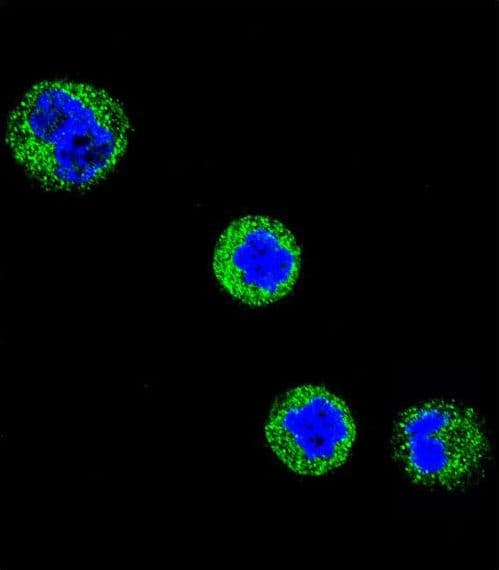 CD1E Antibody (aa184-212)