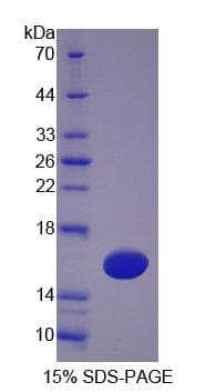 Human TSPAN1 / TM4SF Protein (Recombinant His-S)