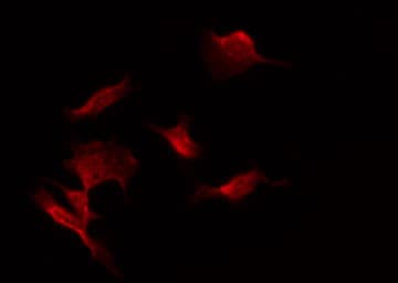 SLC22A18 Antibody