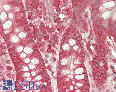 IHC-plus™ Polyclonal Rabbit anti-Human ST14 / Matriptase Antibody (aa800-C-term, IHC, WB)