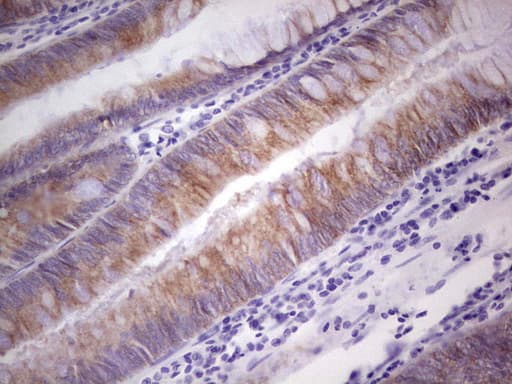 PKD3 / PRKD3 Antibody (aa300-508, clone OTI4G6)
